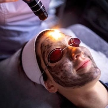 carbon laser