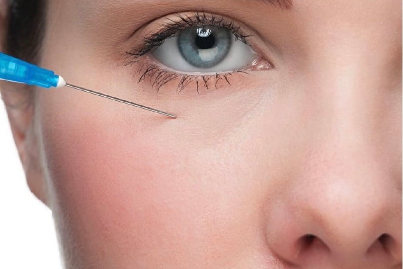 under eye
